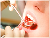 虫歯や歯周病は予防できる病気です